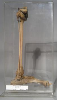 BONE, lower leg, foot